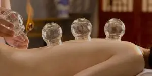Cupping port melbourne